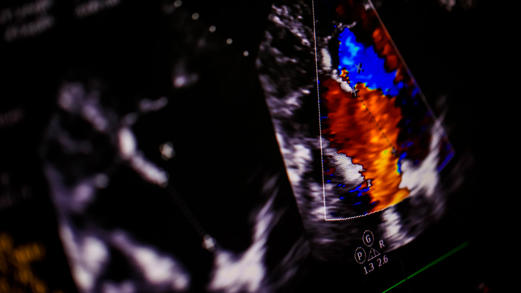 Ultrasonido Doppler Color Endo. Utero y Ovarios