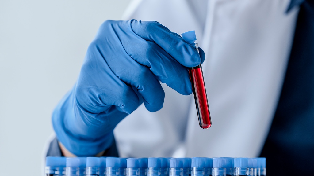 Biometría Hemática V. S. G.