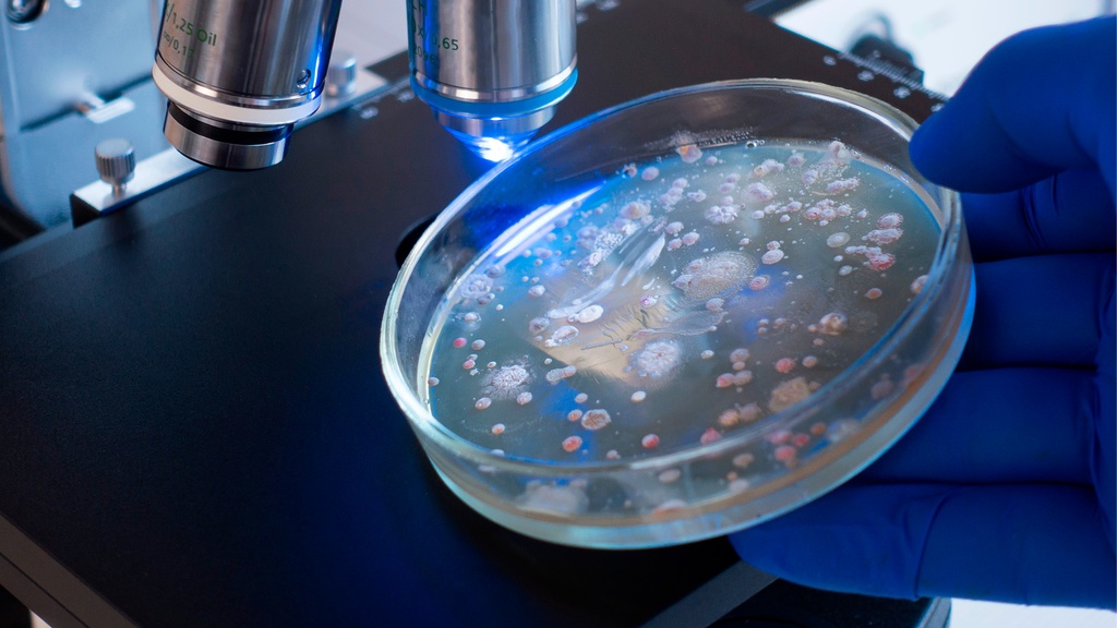 Coproparasitoscópico 1 Muestra