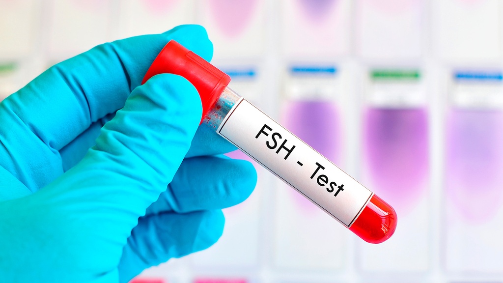 F.S.H.(Hormona Folículo Estimulante)