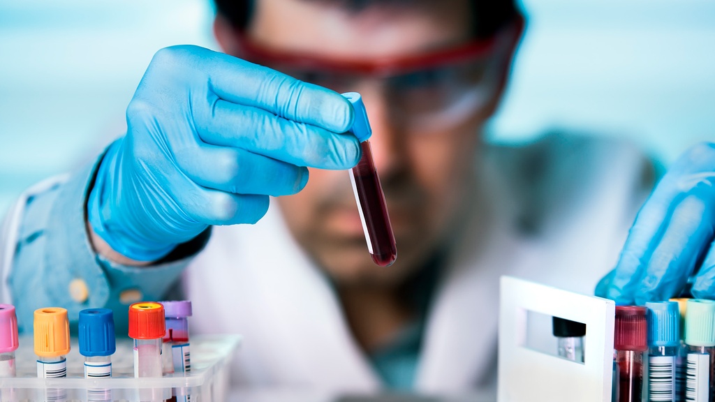 Tiempo de Tromboplastina Parcial