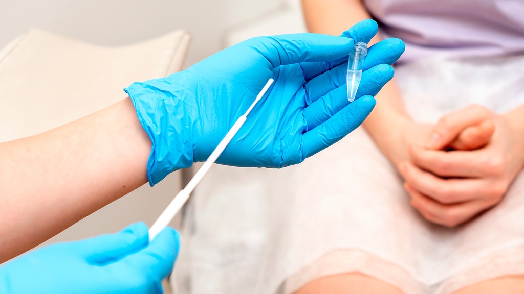 Virus de Papiloma Humano (PCR)