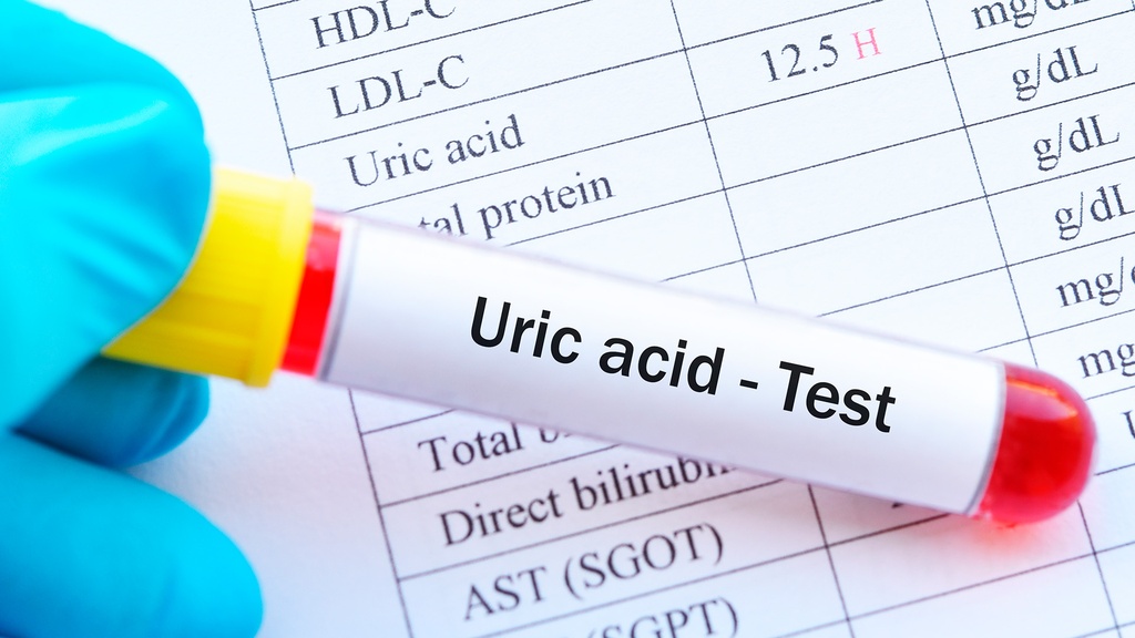 Ácido Úrico Sérico