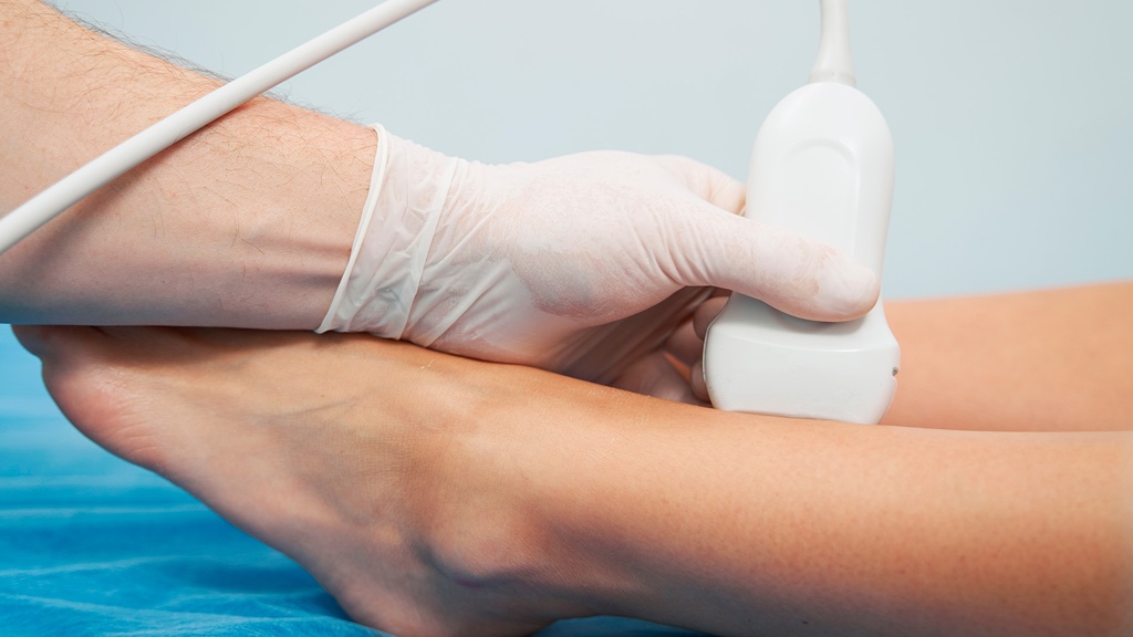 Doppler Arterial De Miembro Inferior Izquierdo