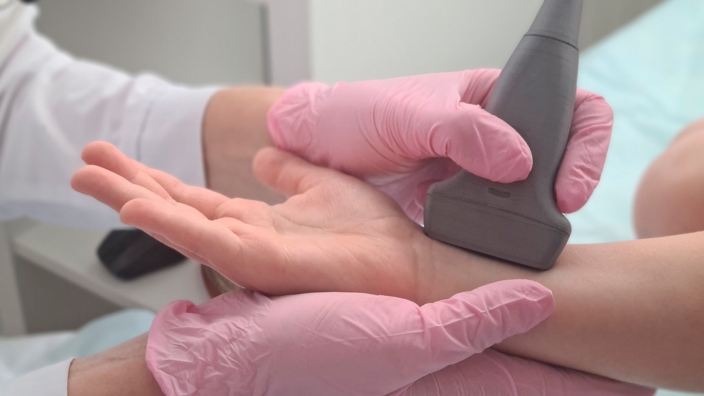 Doppler Venoso De Miembro Superior Derecho