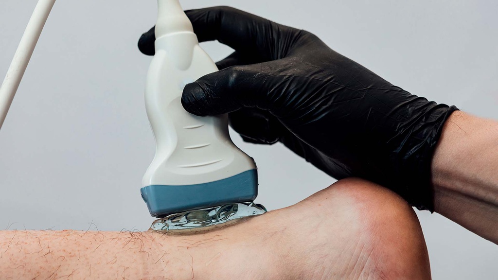 Ultrasonido Tendon De Aquiles