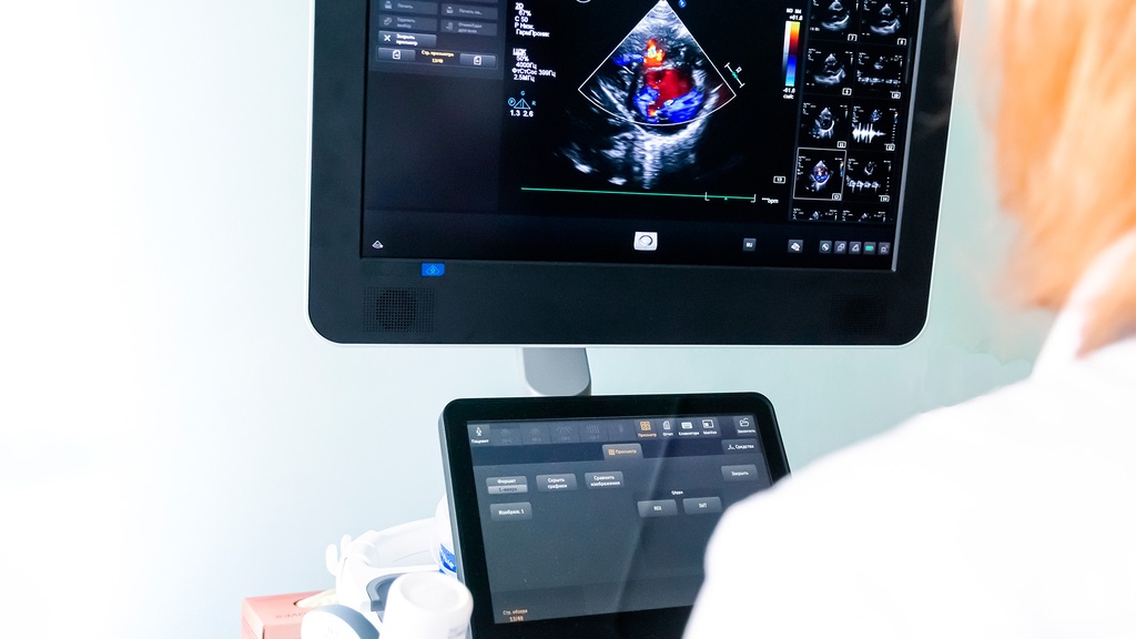 Ultrasonido  Cromosomico