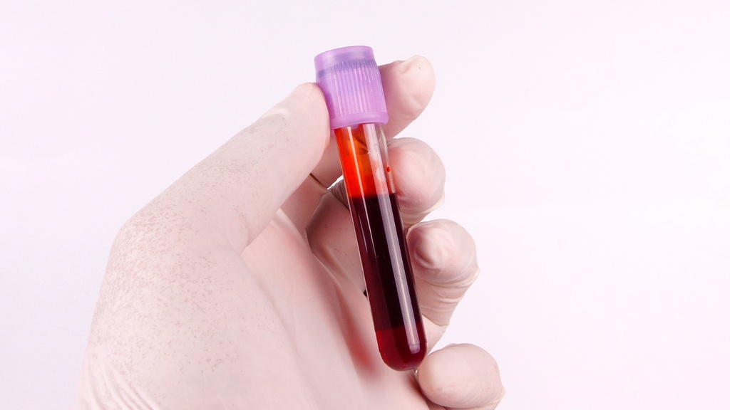 Glucosa Post.-Carga 50g (1 hr) 