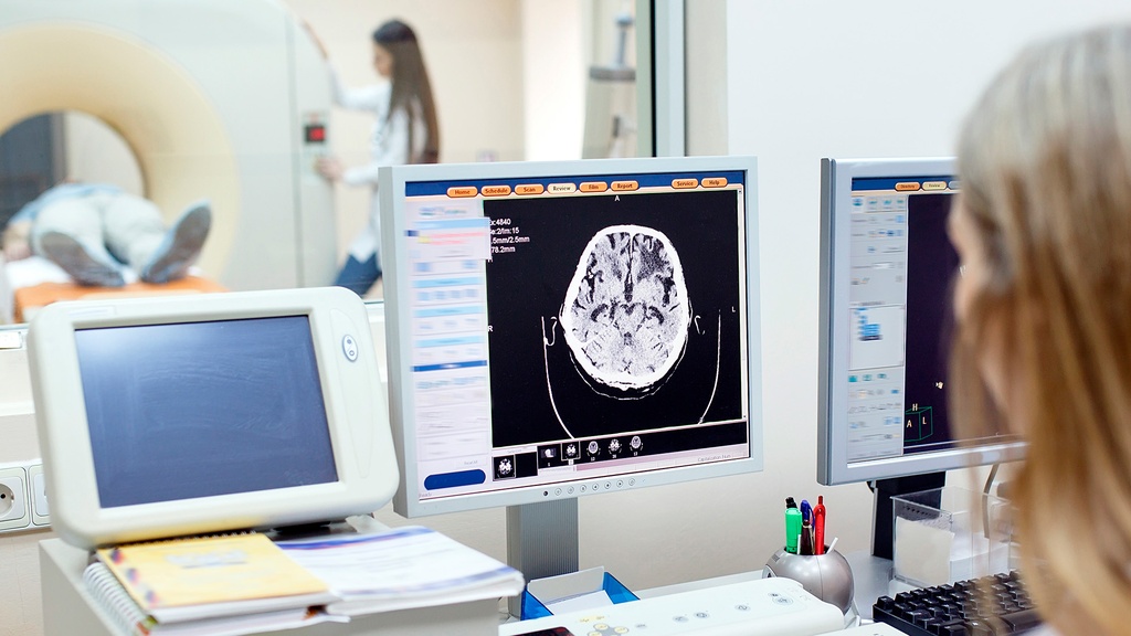 Tomografía Cráneo Simple