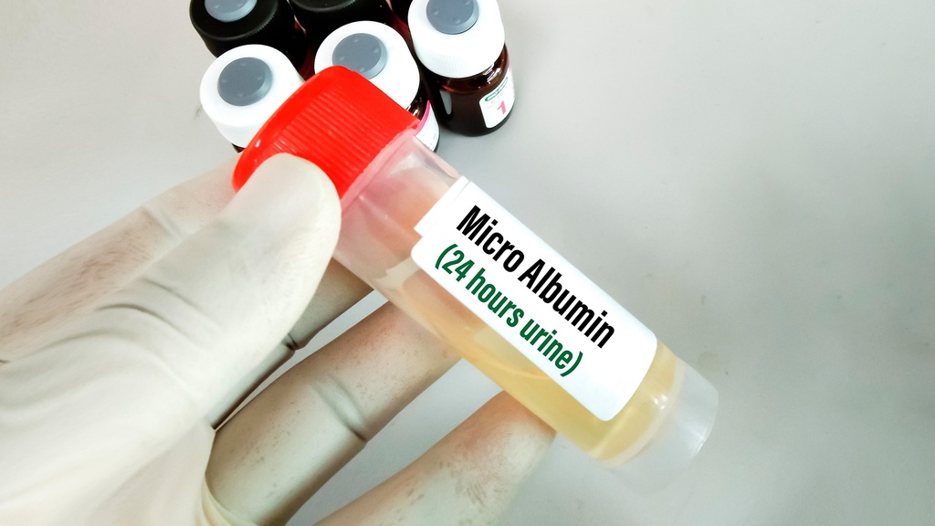 Microalbúmina en orina 24 h