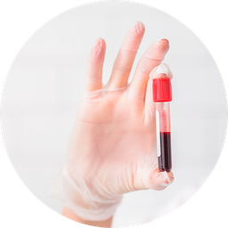 Troponina (alta sensibilidad)