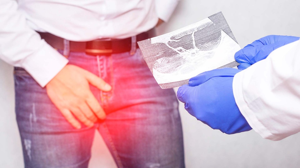 Ultrasonido Inguinal