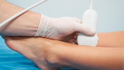 [USDAII] Doppler Arterial De Miembro Inferior Izquierdo