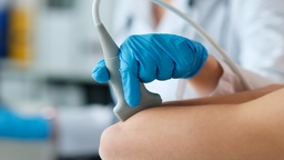 [USDAVSI] Doppler Arterial Y Venoso De Miembro Superior Izquierdo