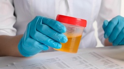 [PRUEMB] Prueba Inmunológica de Embarazo