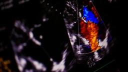 [USOBGD] Ultrasonido Obstetrico Gemelar Doppler Color